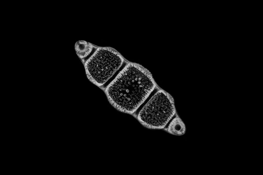 algas diatomeas
